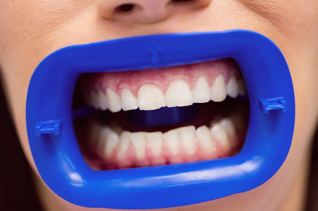 Richmond Orthodontics